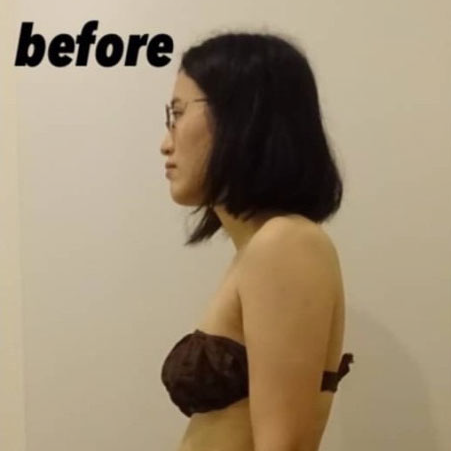 Case 3 Before After