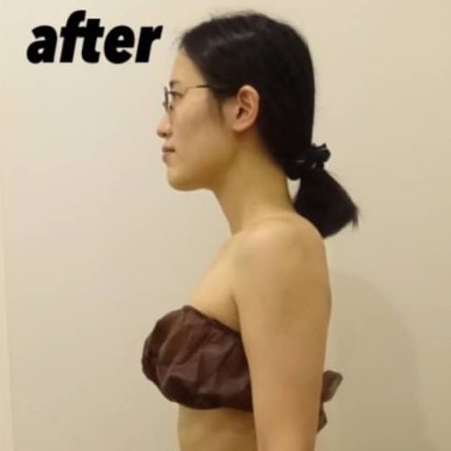 Case 3 Before After